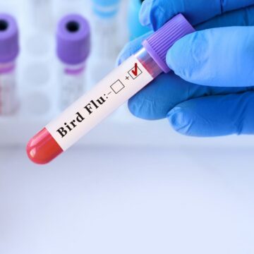 Un Adolescent Din Canada A Fost Testat Pozitiv Pentru Gripă Aviară H5. Autoritățile Anchetează Sursa Infecției. „Acesta Este Un Eveniment Rar”