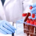 Misterul de peste 50 de ani care a fost rezolvat în medicina modernă. Ce ascunde noua grupă sanguină descoperită de cercetători